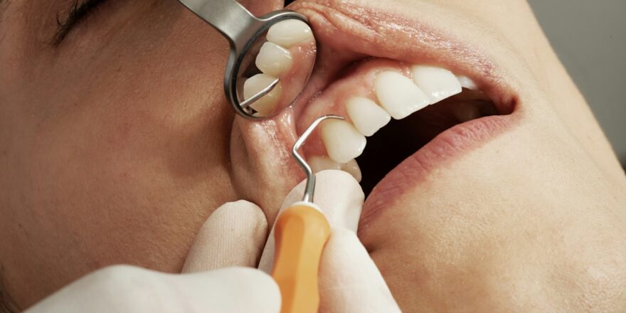 Dental Pain Is a Public Health Warning